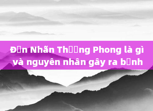 Đơn Nhãn Thương Phong là gì và nguyên nhân gây ra bệnh
