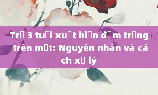 Trẻ 3 tuổi xuất hiện đốm trắng trên mặt: Nguyên nhân và cách xử lý